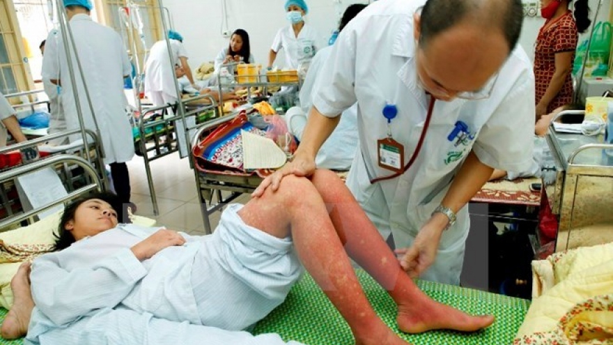 Dengue fever treatment remains weak: official