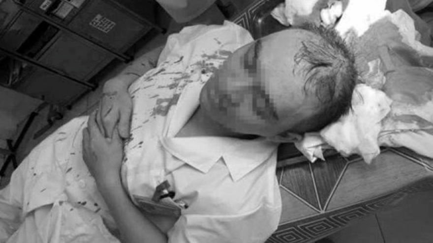 Minister of Health urges police to ensure hospital security