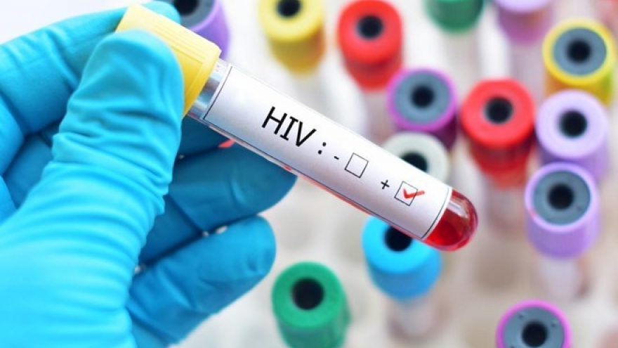 Hanoi has country’s second highest rate of HIV/AIDS