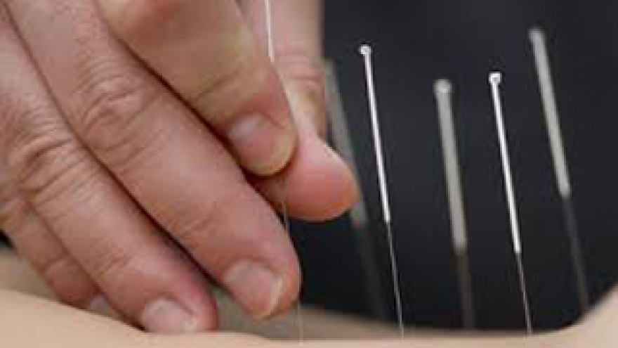 Vietnam, one of 5 countries with most developed acupuncture