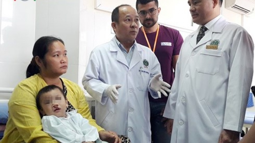 Free surgeries for 650 children with cleft lips, palates