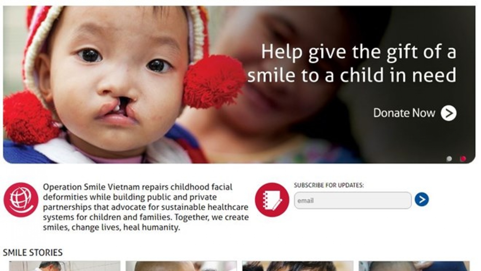 Central Highlands children with cleft lip, palate get free operations