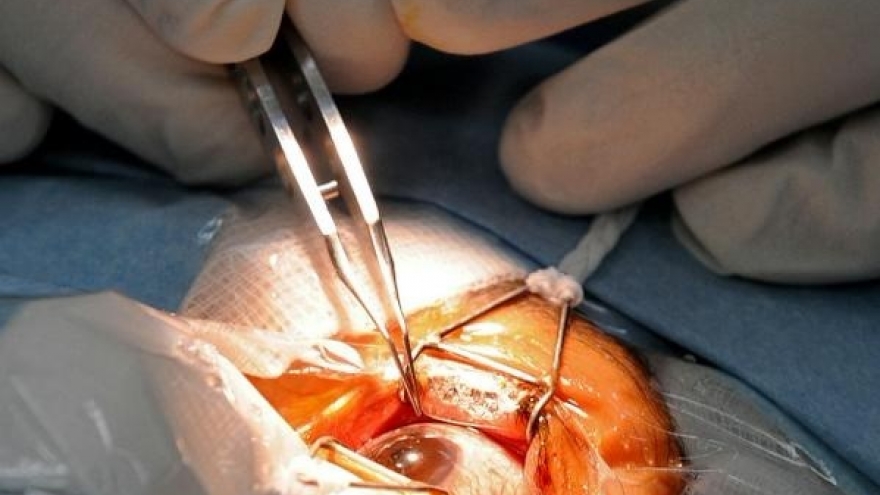 Quang Nam: Free cataract surgeries for policy beneficiaries