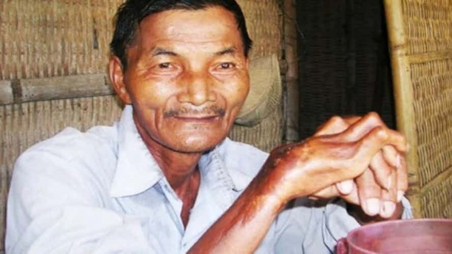 Vietnamese man among world’s top 15 humans with real super powers