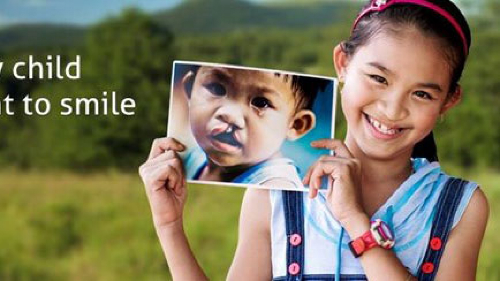 Free cleft lip, palate surgeries for ethnic minority children