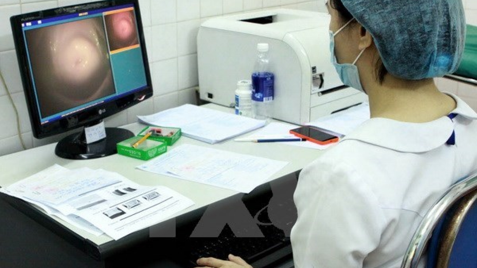 Vietnam shoulders burden of cervical cancer: experts