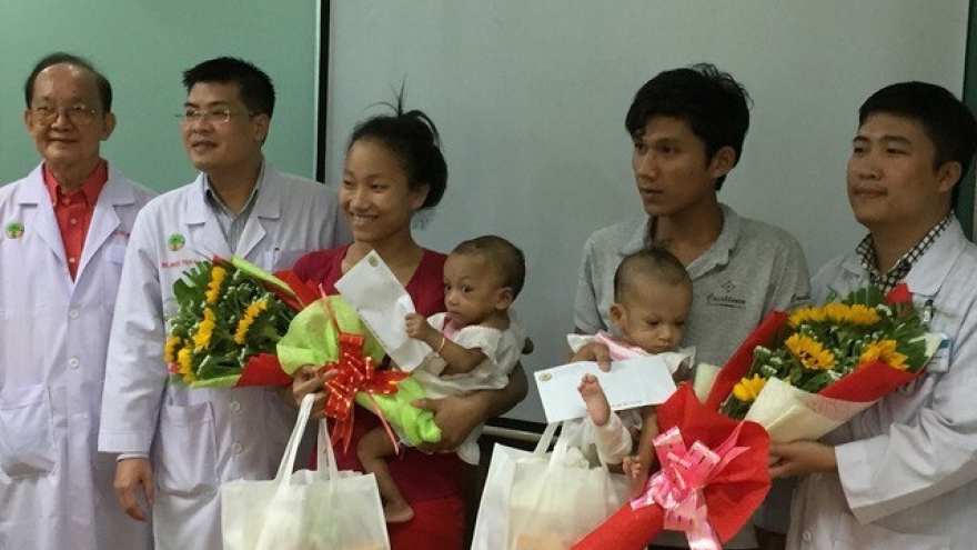 Conjoined twins separated at HCM City’s hospital