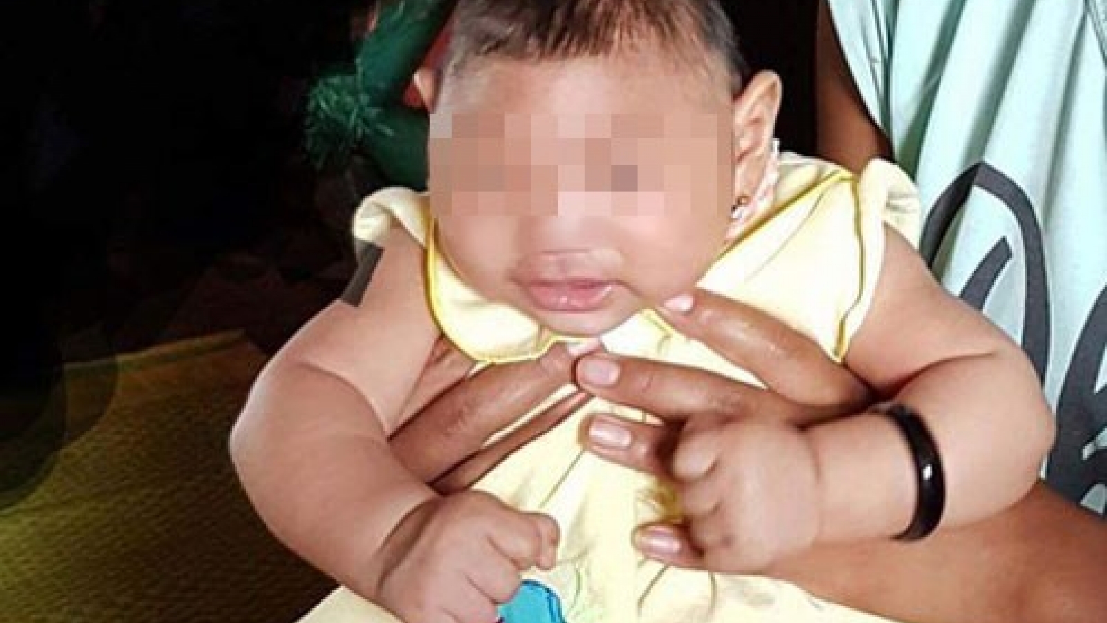 Vietnam confirms first Zika-tied birth defect case