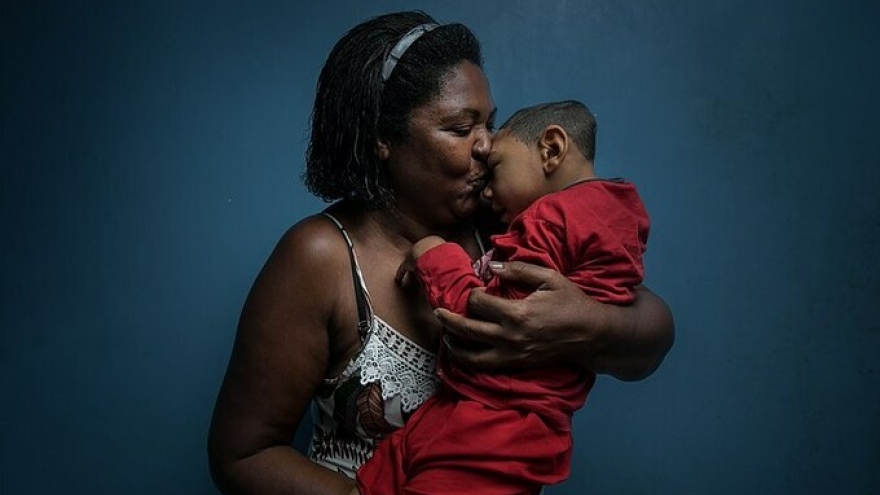 Virus Zika gây nguy hiểm như thế nào khi truyền từ mẹ sang con?