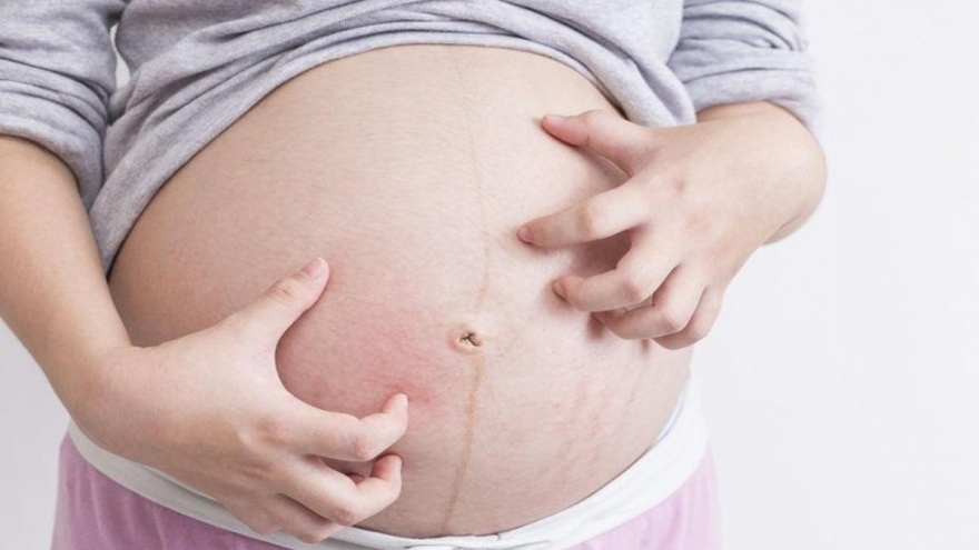 Nguyên nhân gây ngứa vùng bụng