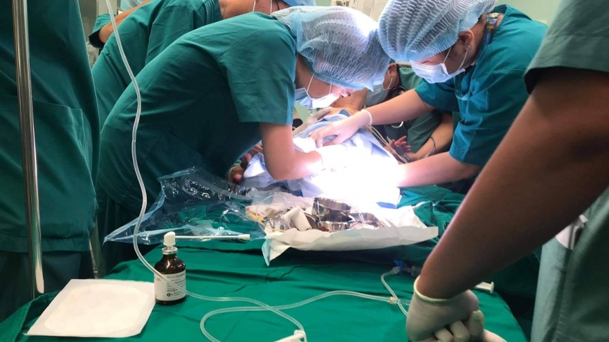 Ca đại phẫu thuật tách 2 bé Trúc Nhi – Diệu Nhi: Tỷ lệ cứu sống là 74%