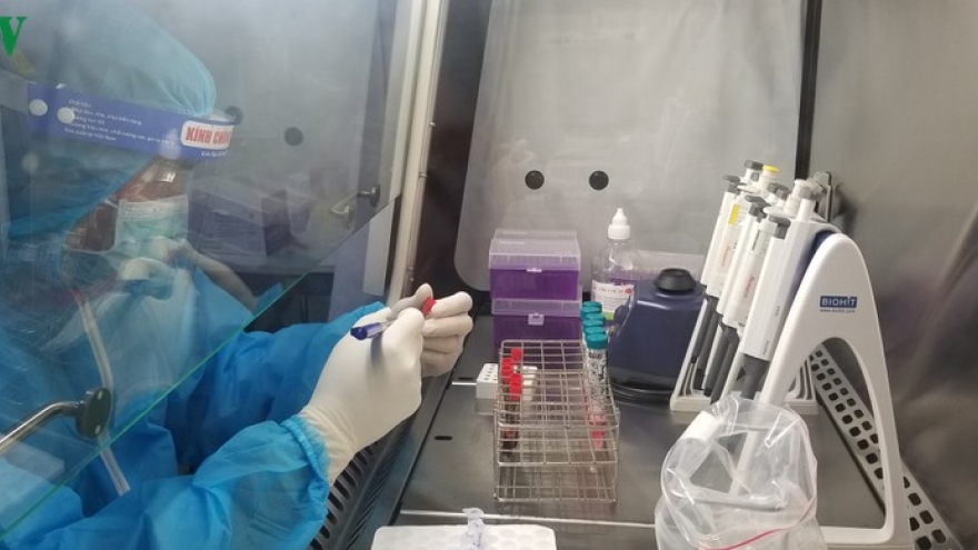 Chuyên gia lý giải về test nhanh, khuyến cáo âm tính vẫn phải cách ly