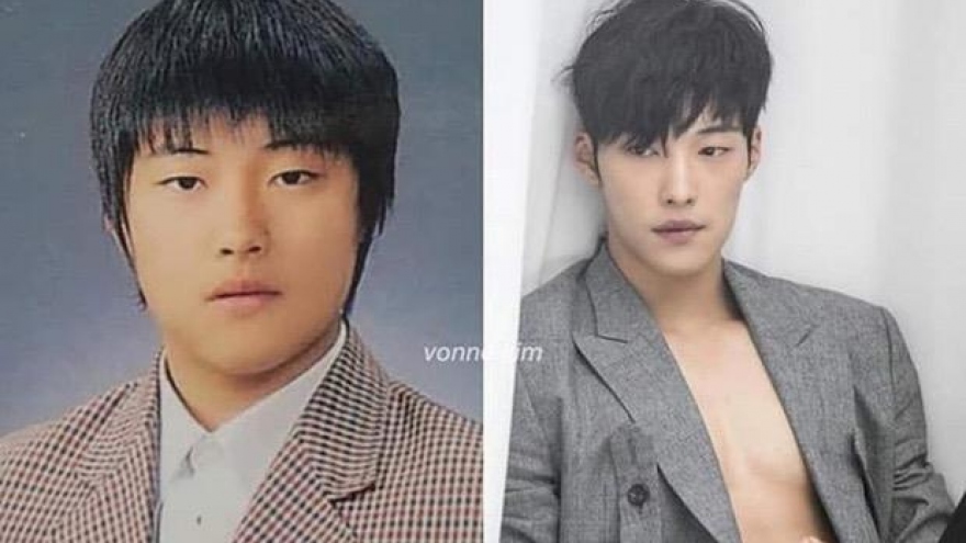 Ngỡ ngàng màn dậy thì thành công của “cận vệ” Woo Do Hwan