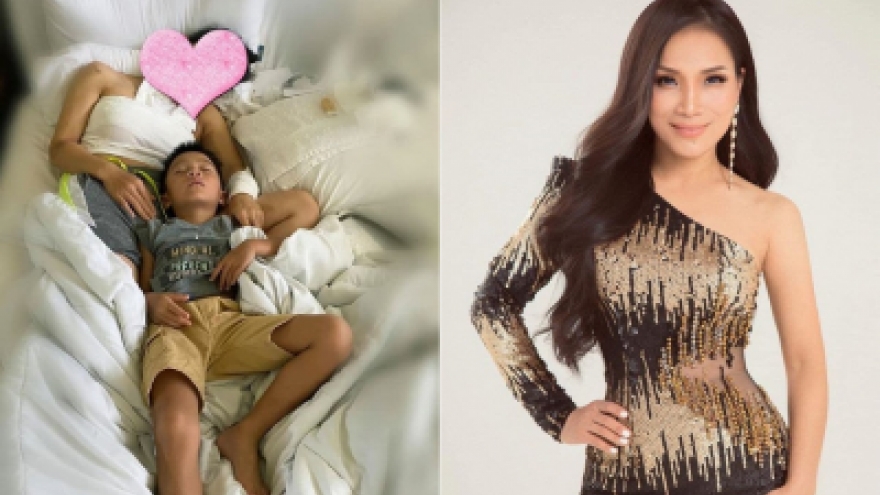 Hồng Ngọc chia sẻ hình ảnh đầu tiên sau 1 tuần bị bỏng vì nổ nồi xông