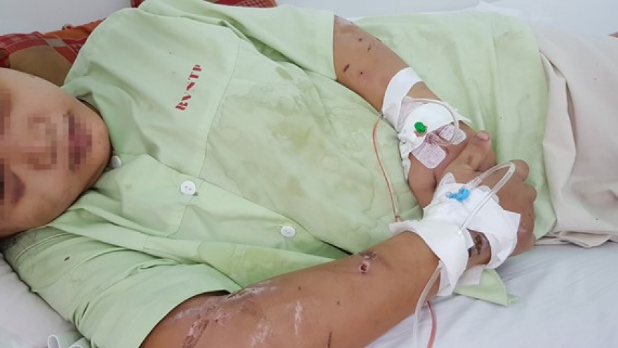 Truy tố 3 bị can tra tấn cô gái 18 tuổi đến sẩy thai