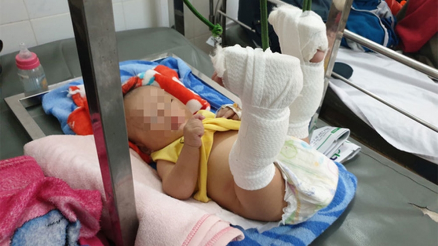 Bé trai 4 tháng tuổi bị cha đánh gãy chân vì không chịu ngủ