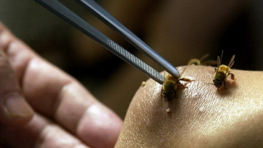 1 cháu bé tại Gia Lai tử vong vì bị ong đốt