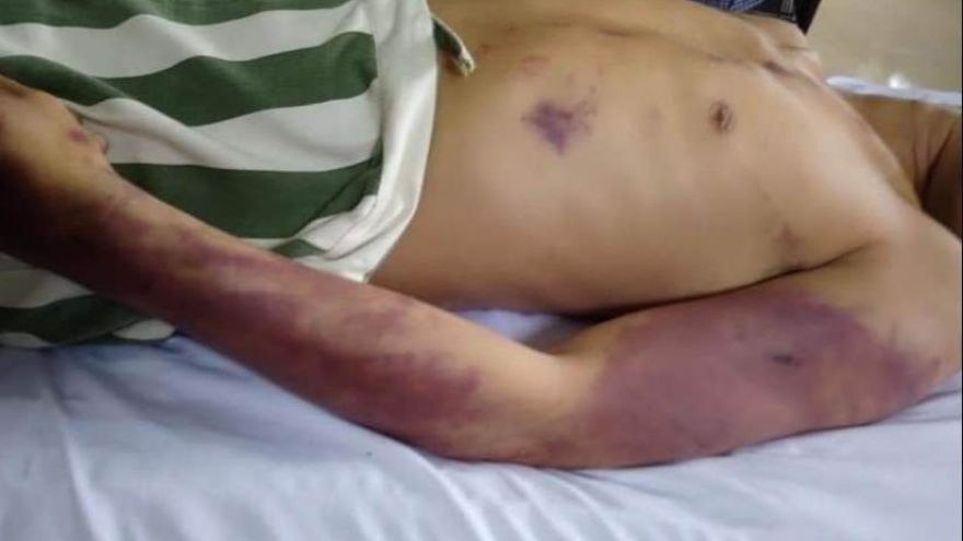 Nóng 24h: Đề nghị kiểm soát đột xuất Nhà tạm giữ CA huyện Châu Đức