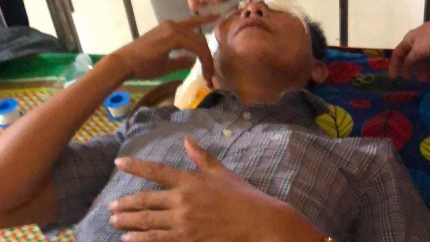 Điều tra vụ người dân bị hất chất lạ vào mặt phải nhập viện điều trị
