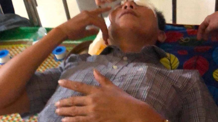 Điều tra vụ người dân bị hất chất lạ vào mặt phải nhập viện điều trị