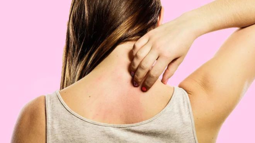 Ngứa ngáy khắp người - dấu hiệu cảnh báo gan đang bị huỷ hoại
