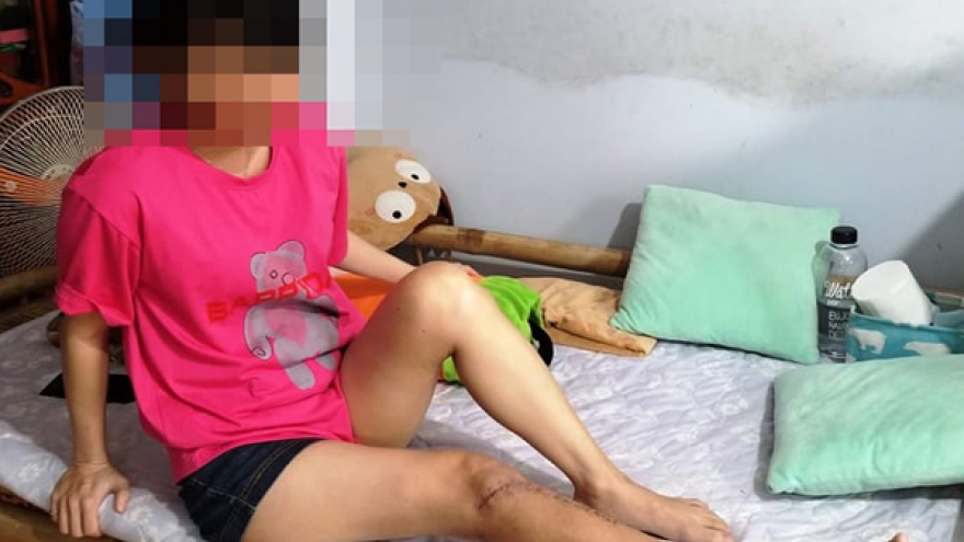 Khởi tố người đánh gãy chân nữ kế toán