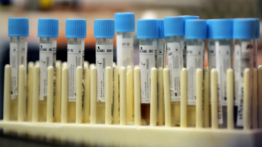 Nhật Bản thử nghiệm lâm sàng dùng huyết tương điều trị Covid-19