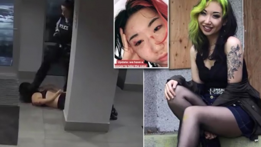 Sững sờ trước cảnh nữ cảnh sát Canada kéo lê và đạp đầu nữ sinh viên y