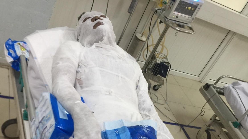 Hé lộ nguyên nhân người đàn ông bị tưới xăng, đốt cháy trên đường