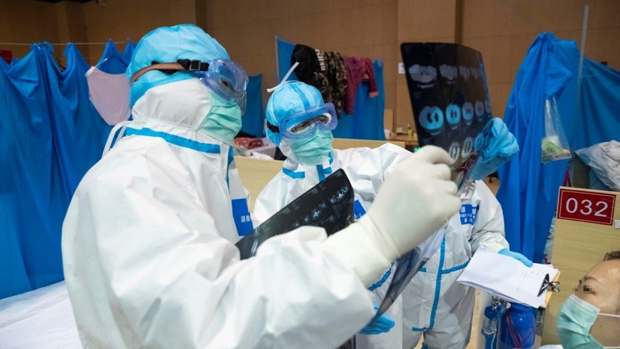 Điều gì quyết định tình trạng nặng - nhẹ của bệnh nhân mắc Covid-19?