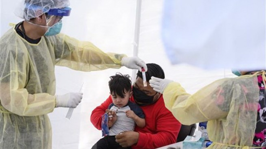 Hội chứng hiếm ở trẻ em liên quan tới Covid-19 xuất hiện ở thanh niên