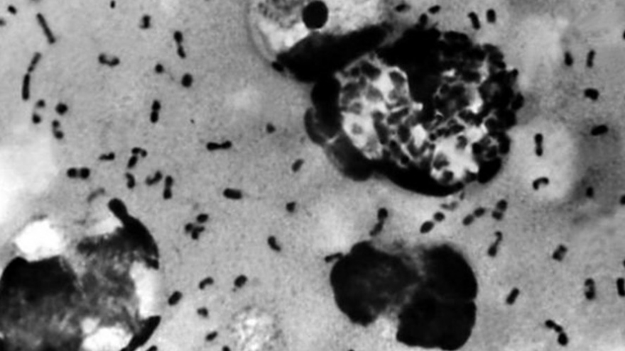 Trung Quốc phát hiện vi khuẩn dịch hạch tại 3 địa điểm ở Nội Mông Cổ
