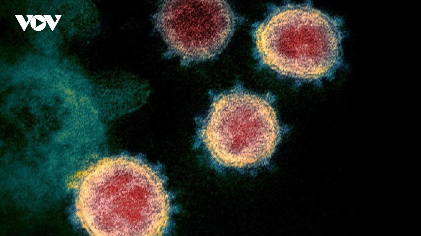 Con người sẽ không thể tự miễn dịch với virus SARS-CoV-2?