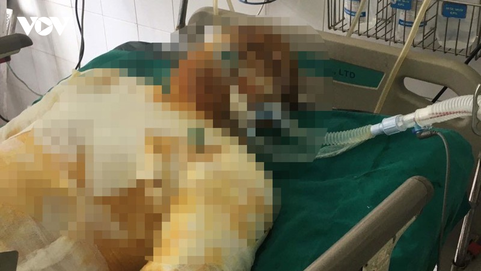 Kẻ tẩm xăng đốt đồng nghiệp cũ bị khởi tố tội “Giết người”
