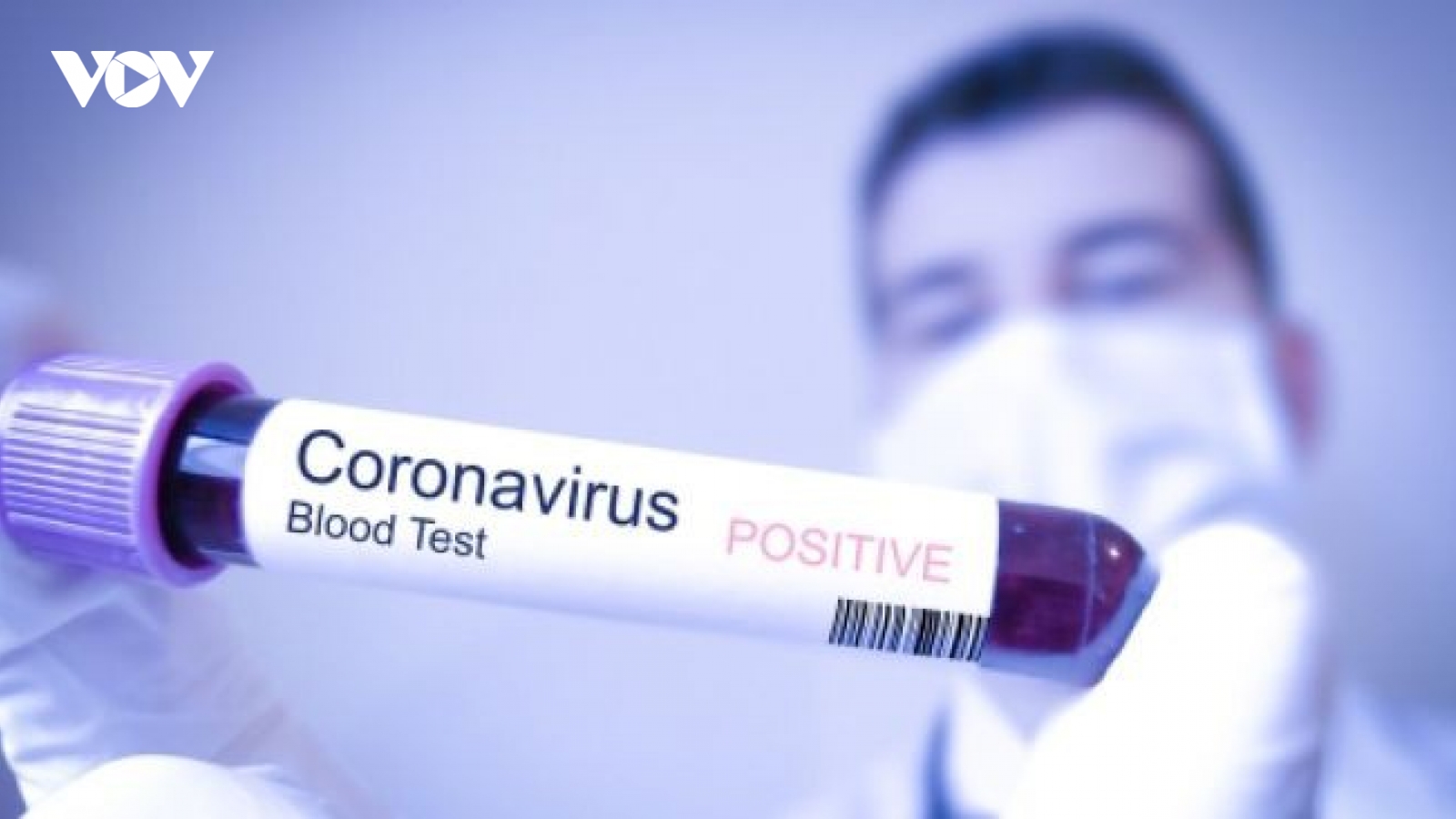 Bệnh nhân tái dương tính với SARS-CoV-2 sau nửa tháng xuất viện