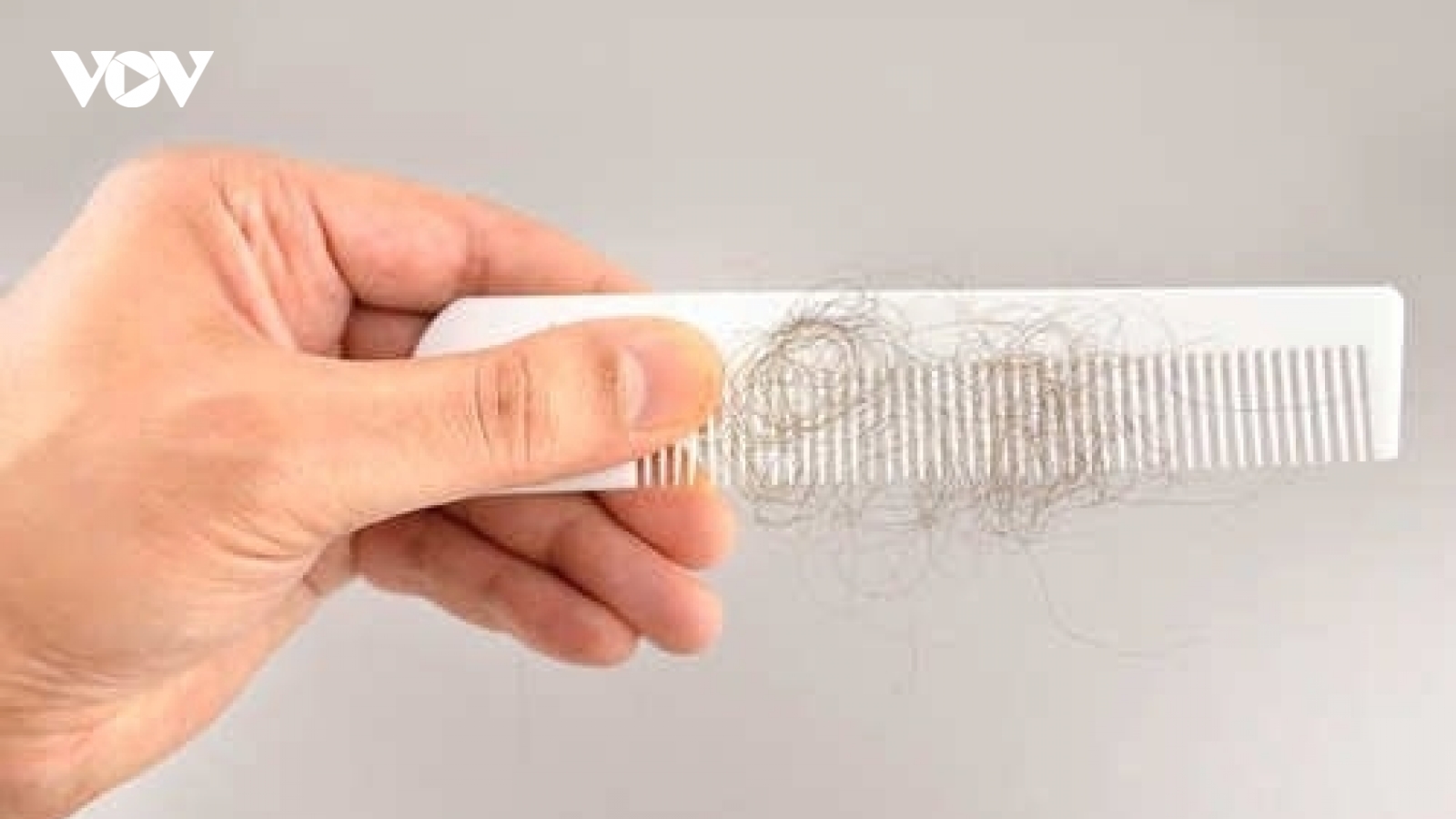 Nỗi ám ảnh rụng tóc và 5 thói quen cần từ bỏ