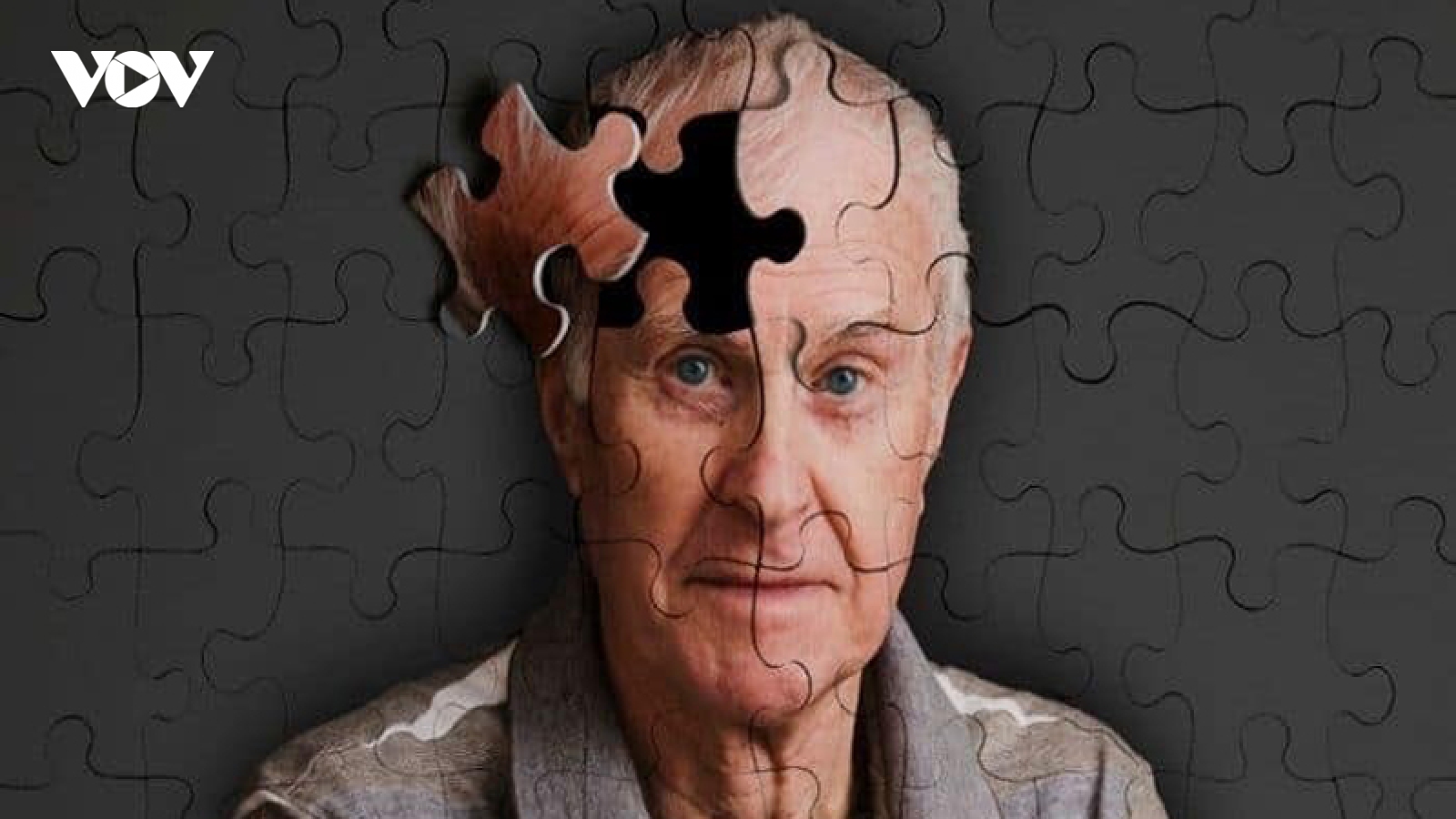 Alzheimer và những dấu hiệu sớm cần lưu ý