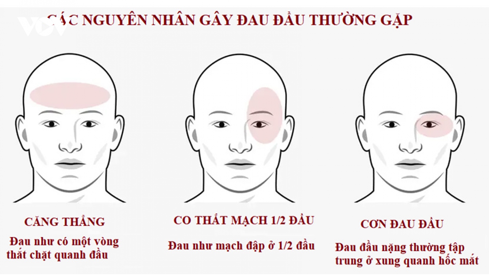 Làm gì khi bị đau đầu?