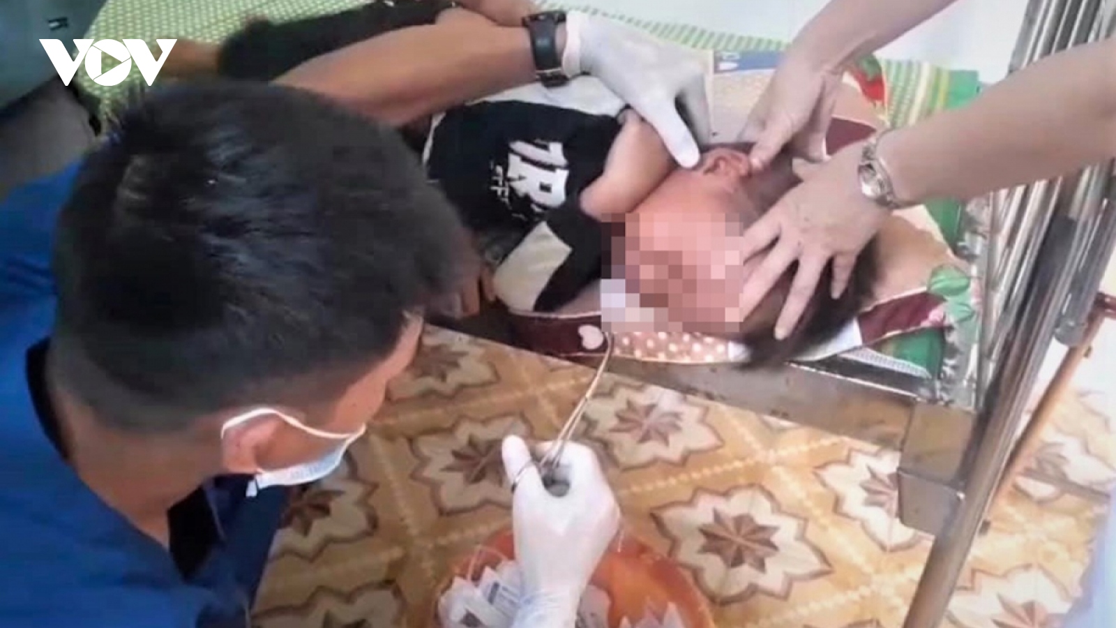 Video: Gắp thành công con đỉa ngoe nguẩy trong mũi bé trai 4 tuổi ở Yên Bái
