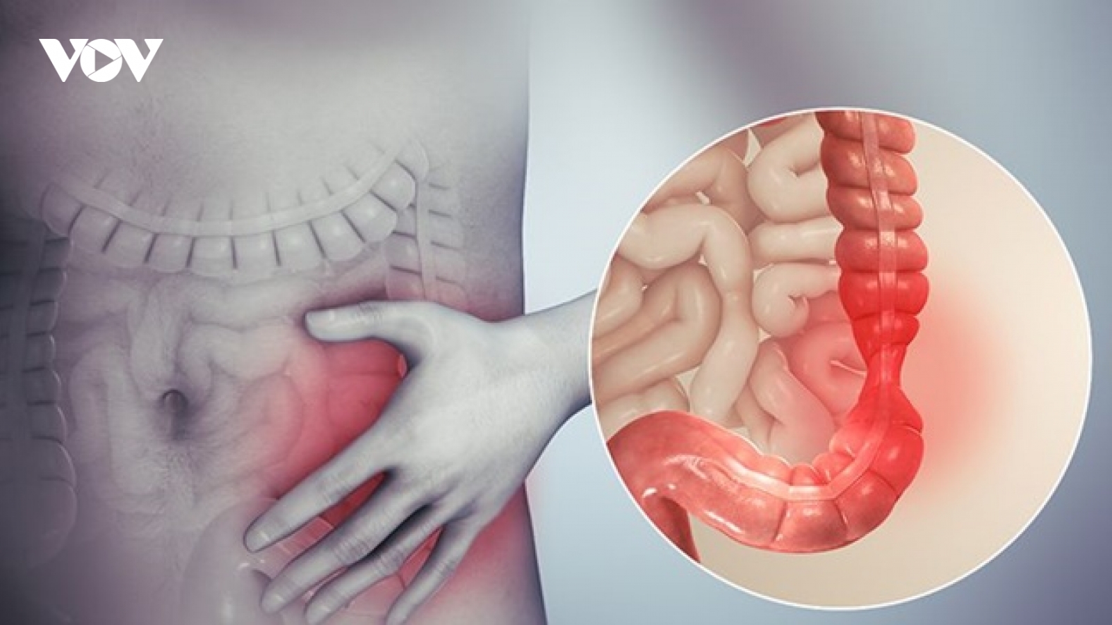 Cách giảm đau đại tràng nhanh, hiệu quả của người Nhật