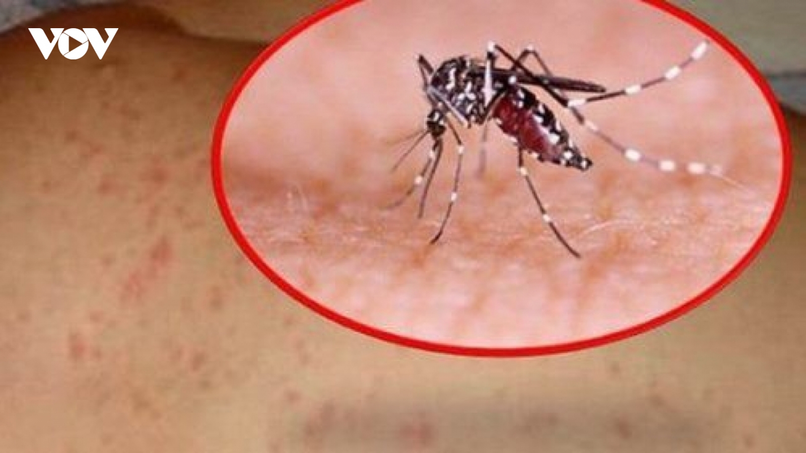 Sốt xuất huyết gia tăng, Kon Tum triển khai biện pháp cấp bách phòng, chống