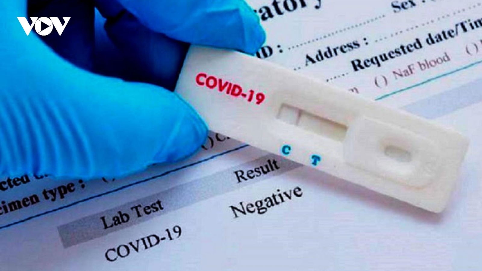 28 bệnh nhân có kết quả xét nghiệm âm tính với COVID-19