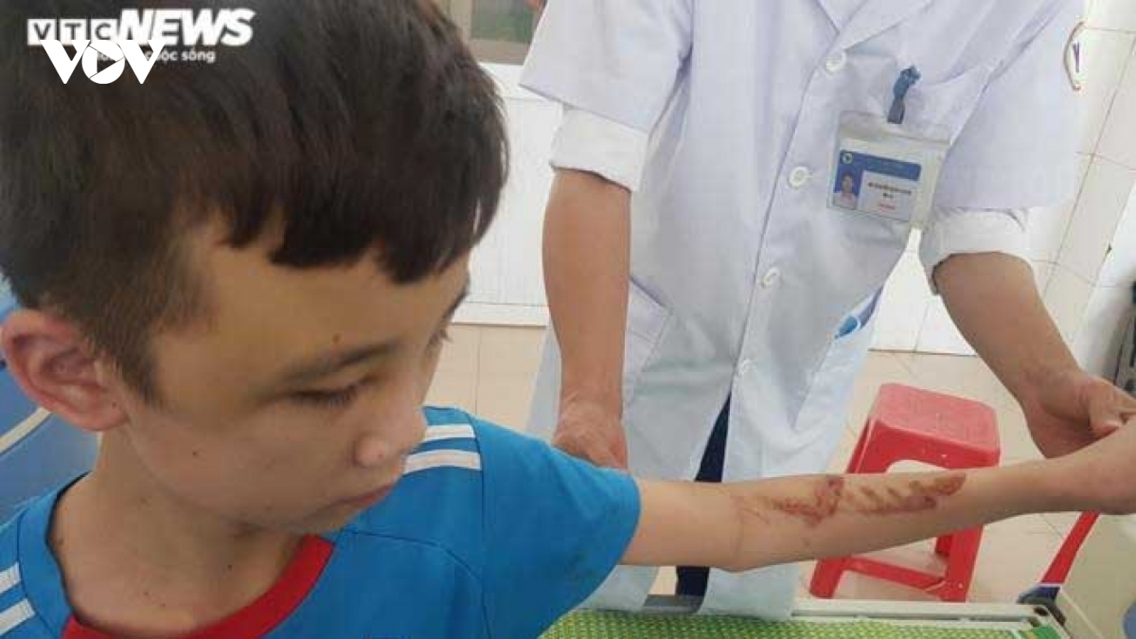 Vụ nhân viên quán bánh xèo bị tra tấn: Sẽ hỗ trợ đưa nạn nhân về nhà
