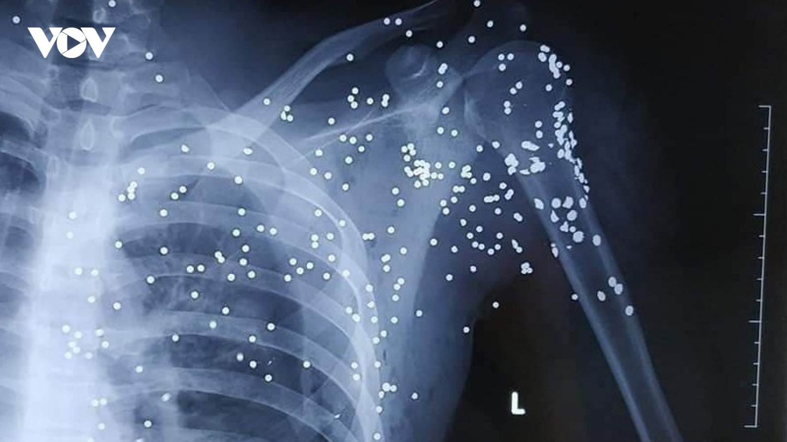 Điều tra vụ nổ súng tại trạm thu phí ở Thái Bình