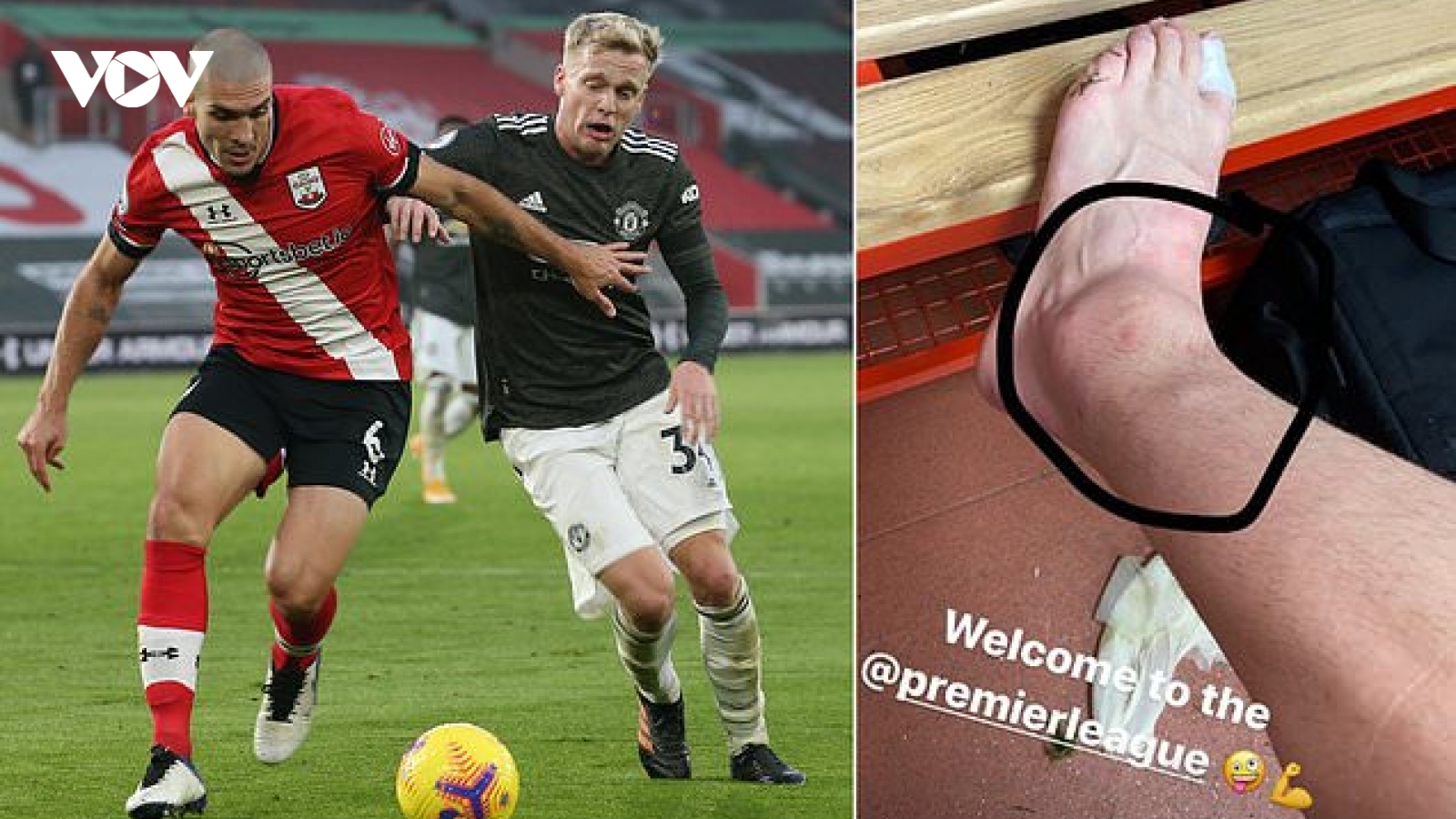Chân Van De Beek biến dạng sau trận Southampton 2-3 MU