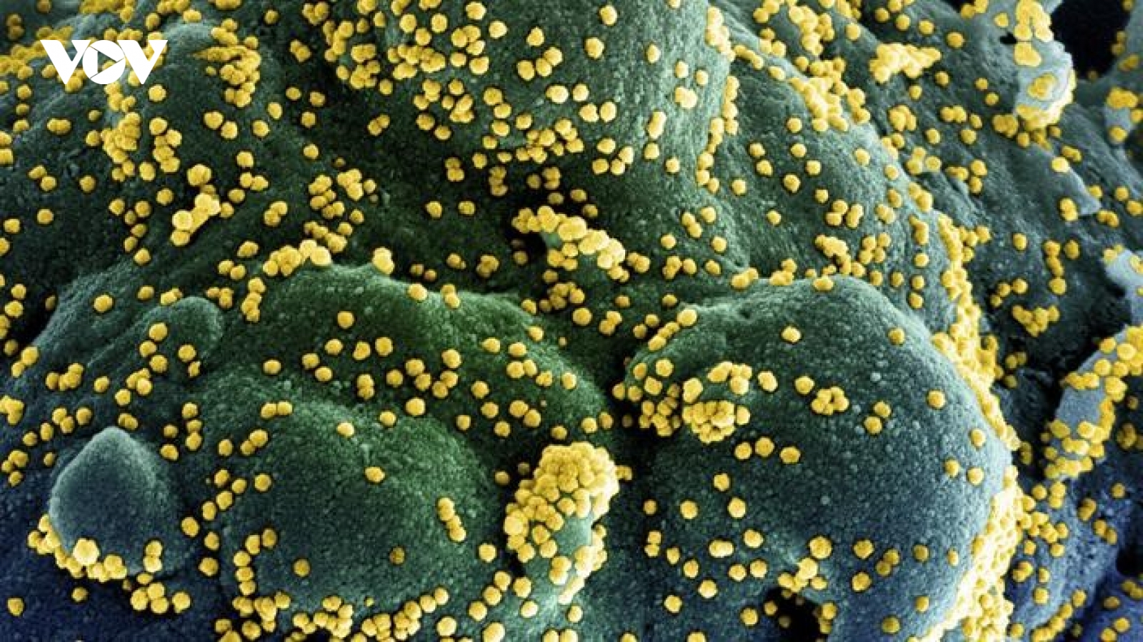 Những biến thể mới của SARS-CoV-2 nguy hiểm đến đâu?