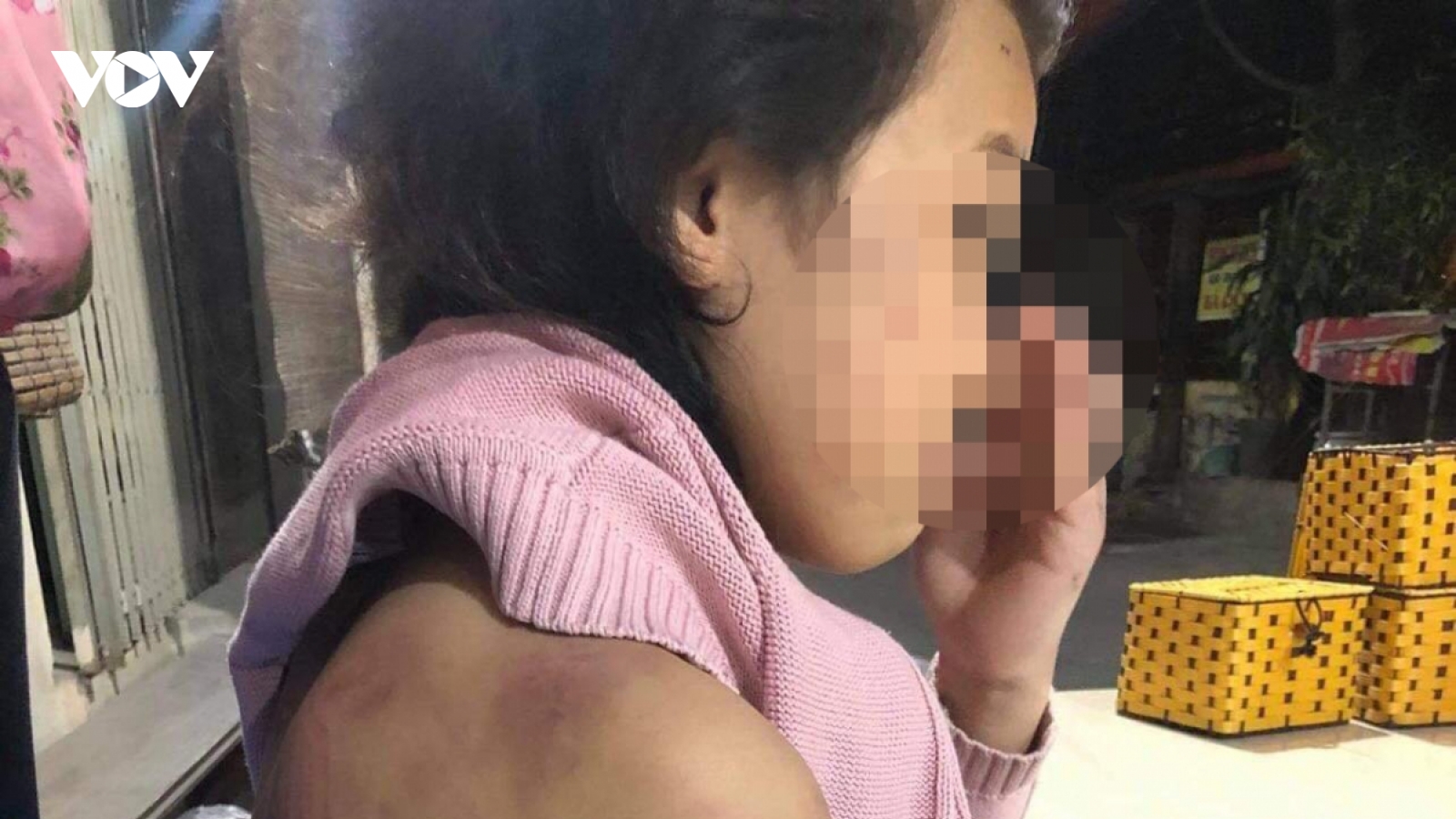 Bé gái bị mẹ đẻ đánh đập dã man đã được hỗ trợ tâm lý, ở cùng bác họ