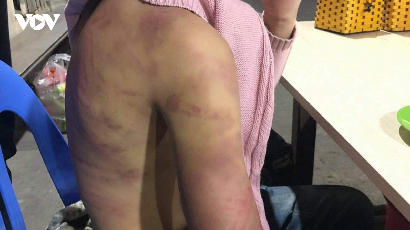 Vụ bé gái 12 tuổi bị mẹ đẻ bạo hành dã man: Đủ dấu hiệu phạm tội, phải khởi tố