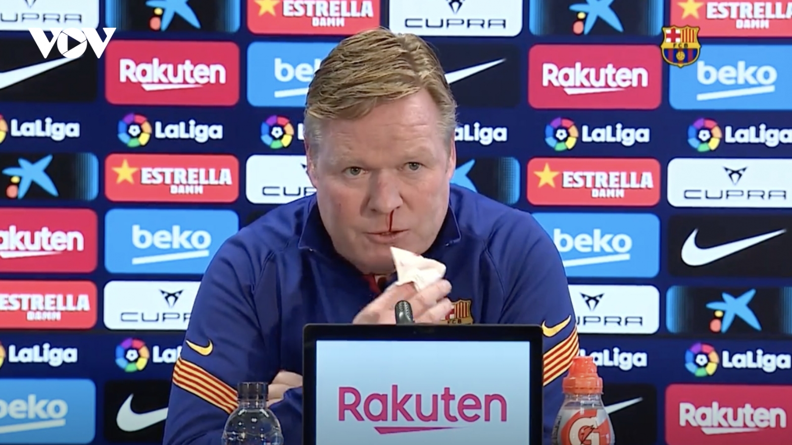 HLV Koeman bỏ dở buổi họp báo của Barca vì bị chảy máu mũi
