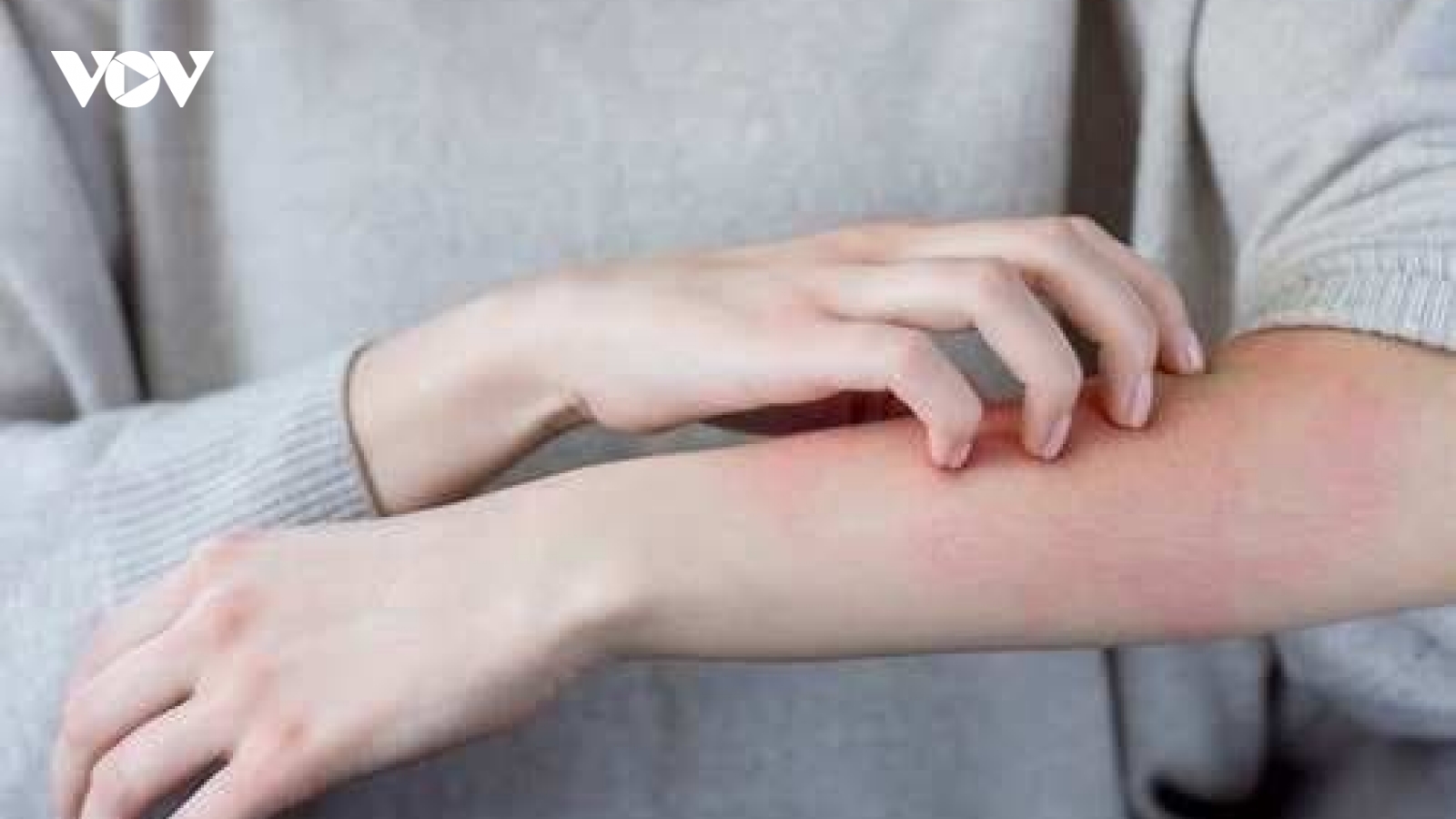 Những tác dụng phụ có thể xảy ra của vaccine COVID-19